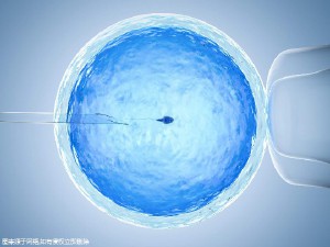 液氮存储